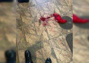 homem-esfaqueia-vizinho-apos-furto-de-cueca-em-varal-;-entenda