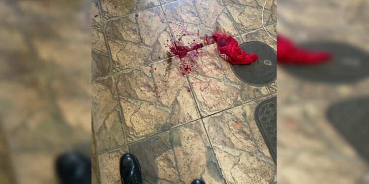 homem-esfaqueia-vizinho-apos-furto-de-cueca-em-varal-;-entenda