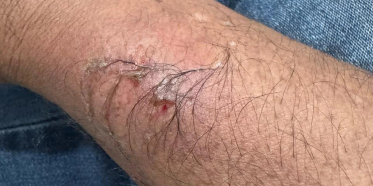 conselheiro-tutelar-e-mordido-por-crianca-na-regiao-noroeste-de-goiania