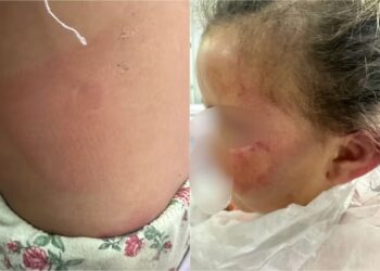 mulher-e-presa-apos-agredir-filha-de-3-anos-por-perder-escova-de-cabelo-em-goias