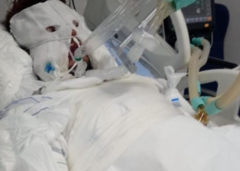 mulher-e-presa-suspeita-de-atear-fogo-no-ex-companheiro-em-rio-verde