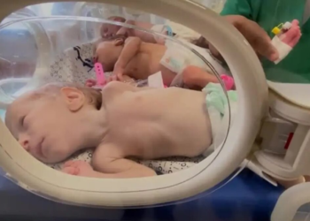 “temos-48-horas-para-salvar-14-mil-bebes”:-onu-alerta-para-fome-catastrofica-em-gaza