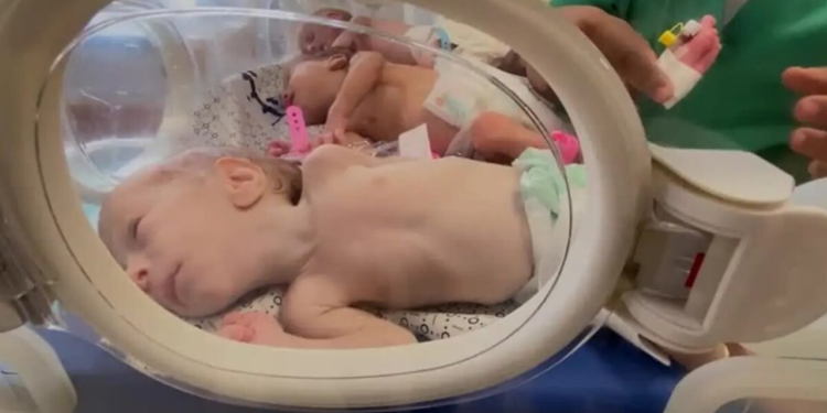 “temos-48-horas-para-salvar-14-mil-bebes”:-onu-alerta-para-fome-catastrofica-em-gaza