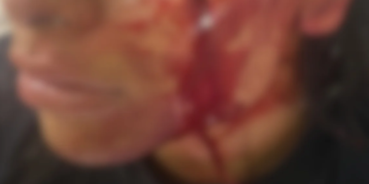 homem-e-preso-apos-agredir-brutalmente-companheira-de-17-anos-em-aparecida-de-goiania