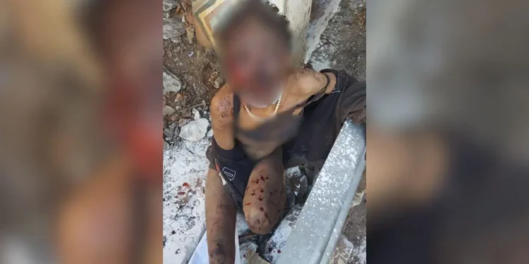 morador-em-situacao-de-rua-agride-mulher-e-tenta-incendia-la-em-goiania