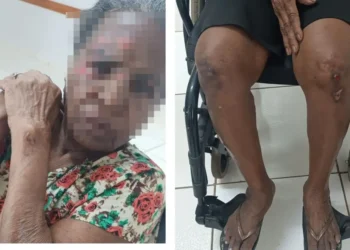 filha-e-presa-apos-espancar-mae-idosa-por-dinheiro-da-aposentadoria-em-trindade