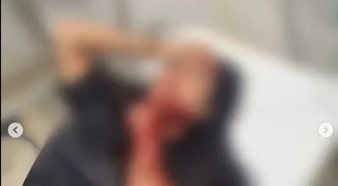 homem-ataca-companheira-com-golpe-de-canivete-no-pescoco-em-jatai