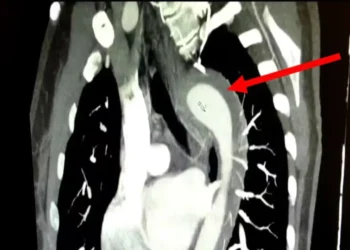 mulher-rompe-aorta-durante-orgasmo-e-sobrevive-em-caso-raro;-entenda