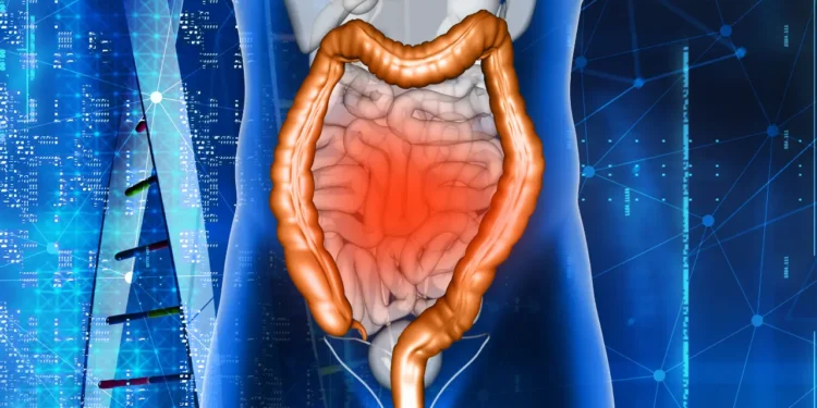 cancer-de-intestino-afeta-pessoas-cada-vez-mais-jovens,-aponta-pesquisa