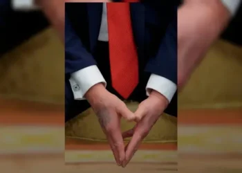 trump-reaparece-com-mao-roxa-e-volta-a-chamar-atencao-mundial