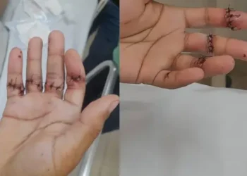 entregador-e-atacado-com-facao-em-aparecida-de-goiania