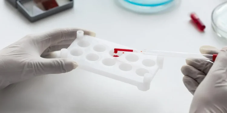 malaria-continua-sendo-desafio-de-saude-publica-no-brasil