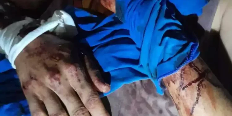 homem-de-28-anos-sofre-ataque-de-onca-no-pantanal