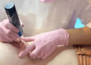 cancer-de-mama-ainda-desafia-saude-publica,-mas-avancos-trazem-esperanca-as-pacientes