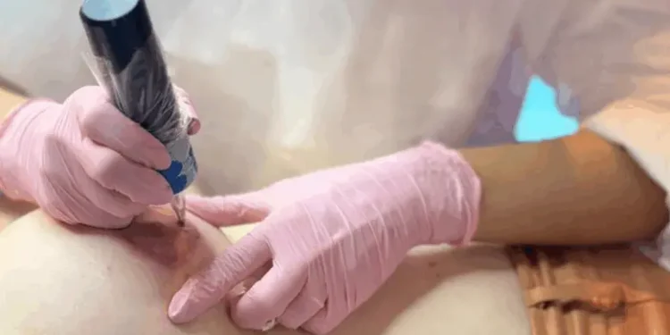 cancer-de-mama-ainda-desafia-saude-publica,-mas-avancos-trazem-esperanca-as-pacientes