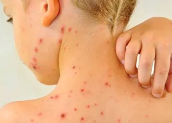 goias-registra-152-casos-de-meningite-e-21-mortes-em-2025