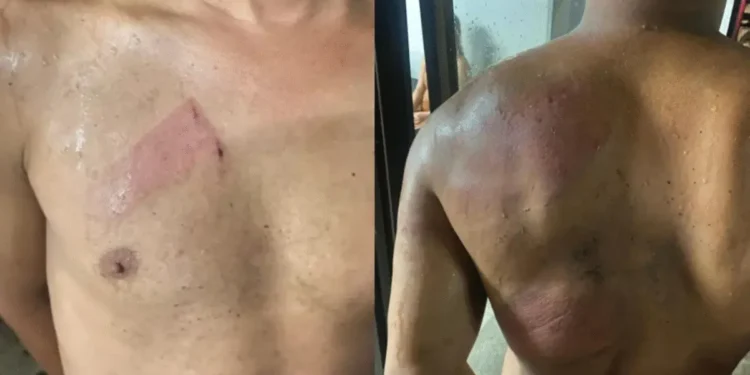 homem-e-preso-em-flagrante-por-abuso-de-sobrinho-de-2-anos-em-aparecida-de-goiania