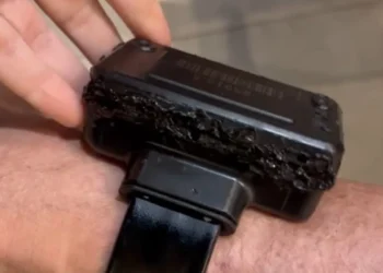 bolsonaro-admite-uso-de-solda-em-tornozeleira;-veja-video