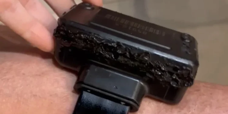 bolsonaro-admite-uso-de-solda-em-tornozeleira;-veja-video