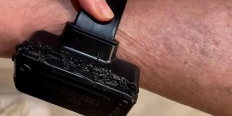 confissao-de-bolsonaro-sobre-tornozeleira-desmonta-estrategia-da-defesa