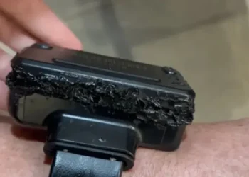 gdf-pagara-por-tornozeleira-violada-–-conta-alta-a-vista