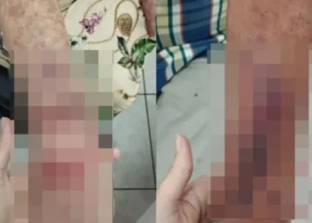 briga-entre-vizinhos-termina-com-idosa-ferida-em-condominio-de-aparecida