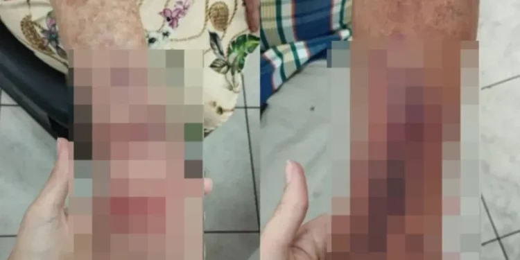 briga-entre-vizinhos-termina-com-idosa-ferida-em-condominio-de-aparecida