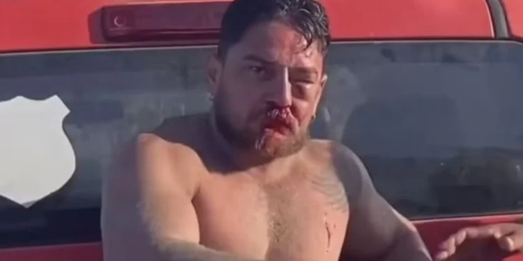 turistas-sao-agredidos-em-porto-de-galinhas-apos-discussao-por-valor-de-cadeiras