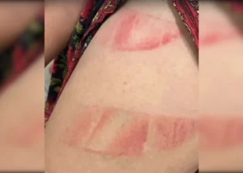 pm-prende-homem-apos-ataque-brutal-contra-companheira-e-filha-de-1-ano-em-novo-gama