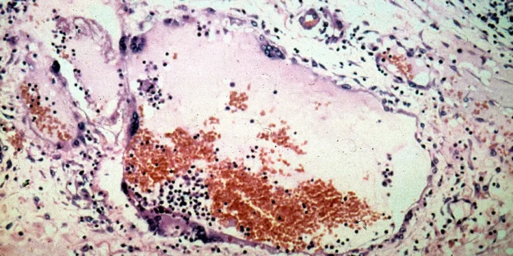 virus-provoca-alerta-sanitario-na-asia-apos-casos-na-india