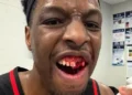 lance-duro-na-nba-termina-com-pivo-com-dentes-quebrados-apos-cotovelada;-veja-o-video