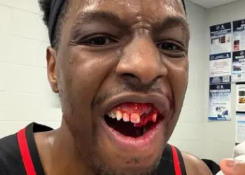 lance-duro-na-nba-termina-com-pivo-com-dentes-quebrados-apos-cotovelada;-veja-o-video