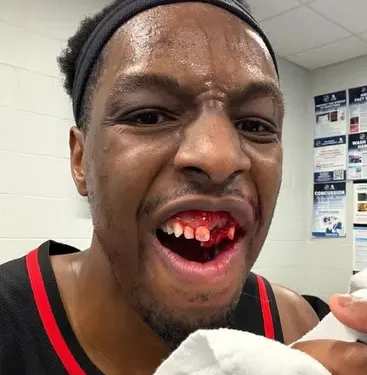 lance-duro-na-nba-termina-com-pivo-com-dentes-quebrados-apos-cotovelada;-veja-o-video
