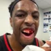 lance-duro-na-nba-termina-com-pivo-com-dentes-quebrados-apos-cotovelada;-veja-o-video