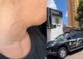 mulher-denuncia-agressao-do-companheiro-em-goiania-e-pede-medida-protetiva