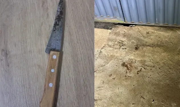 filha-esfaqueia-o-proprio-pai-apos-discussao-em-aparecida-de-goiania