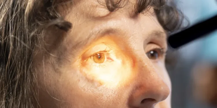 mais-da-metade-das-cegueiras-sao-por-catarata,-com-alerta-no-abril-marrom