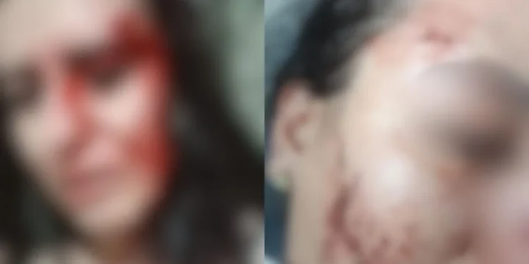 jovem-denuncia-ex-companheiro-por-agressoes,-ameacas-e-invasao-de-domicilio-em-anapolis