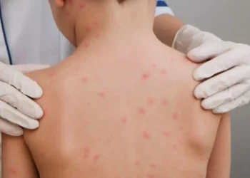 goias-registra-232-casos-de-meningite-em-2025-e-11-mortes-em-2026