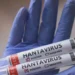 eua-registra-primeira-morte-por-hantavirus-apos-repercussao-de-casos-em-cruzeiro