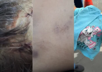crianca-de-2-anos-morre-com-sinais-de-agressao-em-aparecida-de-goiania;-pai-e-baba-sao-detidos