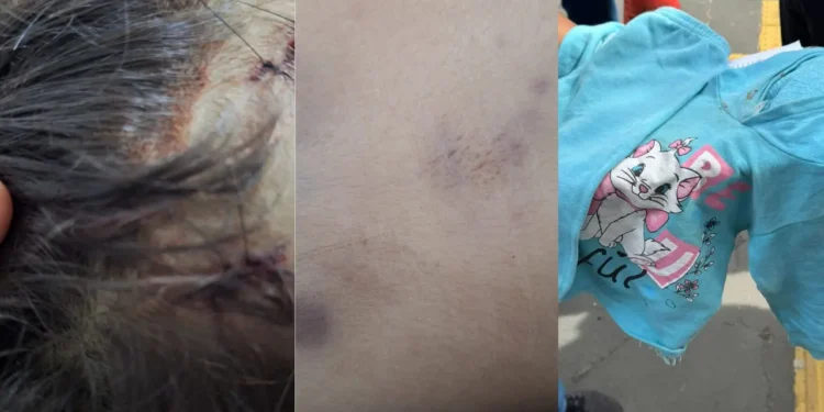 crianca-de-2-anos-morre-com-sinais-de-agressao-em-aparecida-de-goiania;-pai-e-baba-sao-detidos