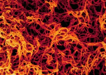 oms-alerta-para-risco-sobre-subestimar-novo-surto-de-ebola-na-africa
