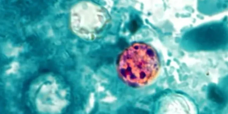 surto-de-infeccao-intestinal-nos-eua-atinge-mais-de-10-mil-pessoas-e-ja-soma-dois-mortos