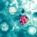 surto-de-infeccao-intestinal-nos-eua-atinge-mais-de-10-mil-pessoas-e-ja-soma-dois-mortos