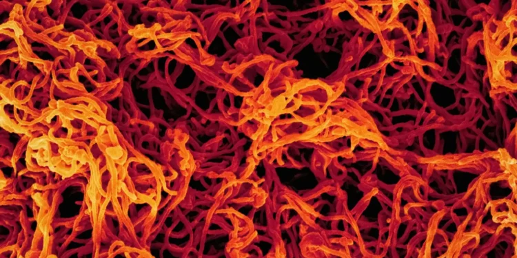 oms-alerta-para-risco-de-expansao-internacional-de-surto-de-ebola-no-congo
