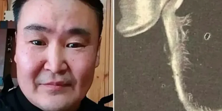 homem-descobre-planta-crescendo-no-olho-apos-acidente-com-galho